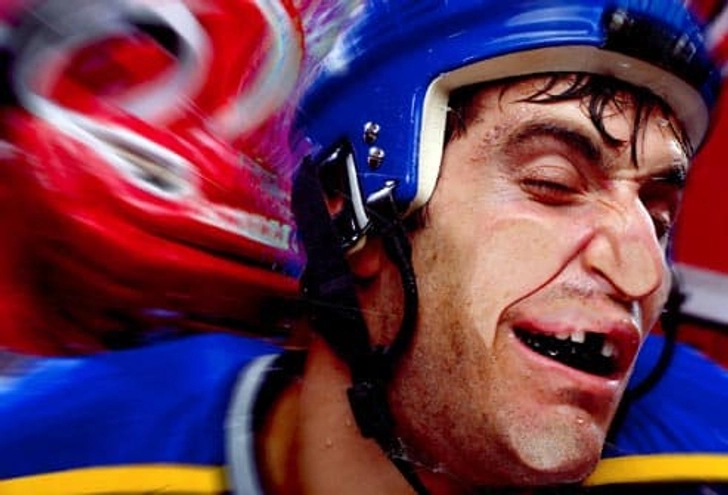 Playing Sports With No Mouth Guard