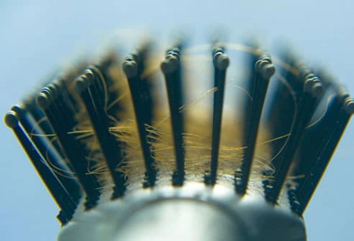 How Much Hair Loss Is Normal?
