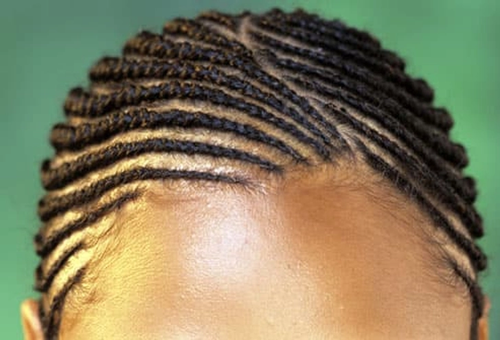 Hair Loss Trigger: Tight Hairstyles