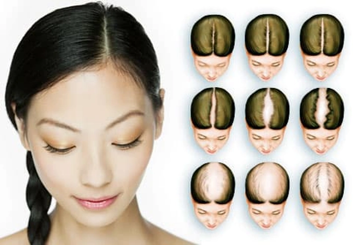 Can You Measure Hair Loss?
