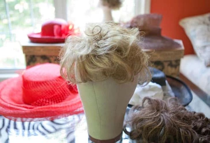 How to Handle Major Hair Loss