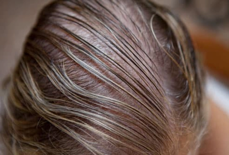 What Are the Roots of Hair Loss? What Are the Roots of Hair Loss?