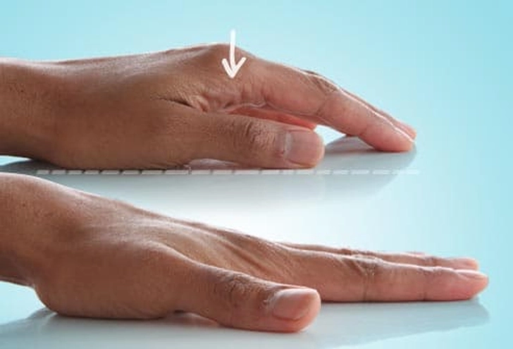 Finger Stretch