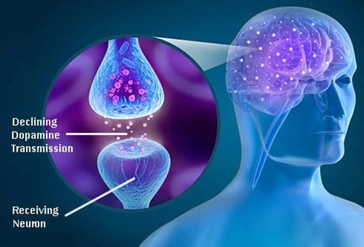 Parkinson’s Disease