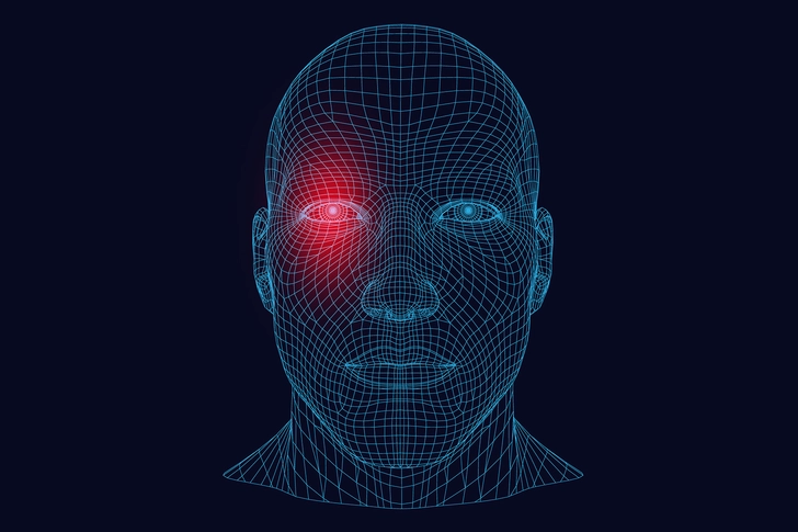 Cluster Headaches