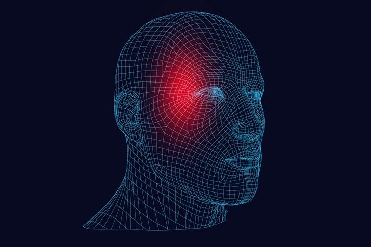 Migraines
