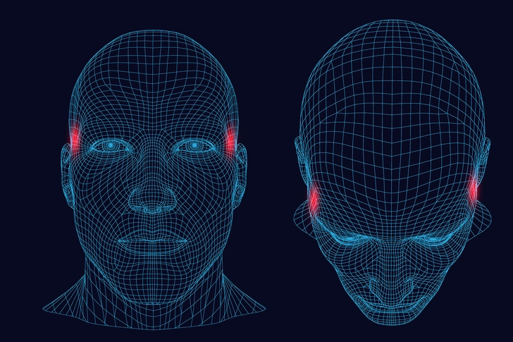 Tension Headaches Tension Headaches