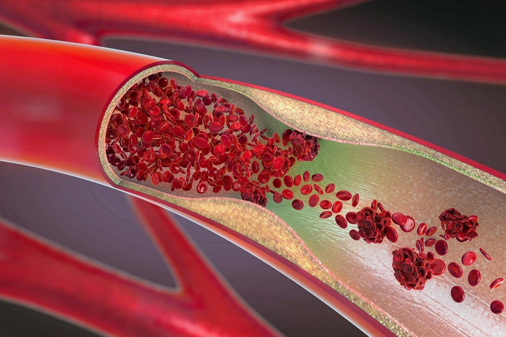 Unclear on Cholesterol