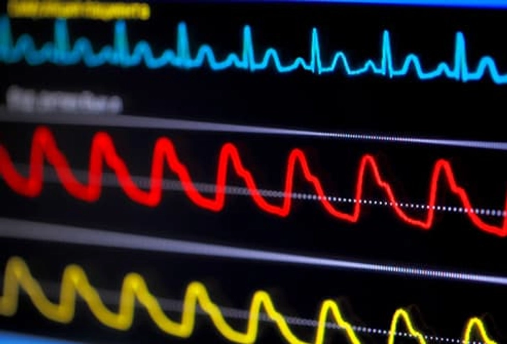 Heart Disease Heart Disease