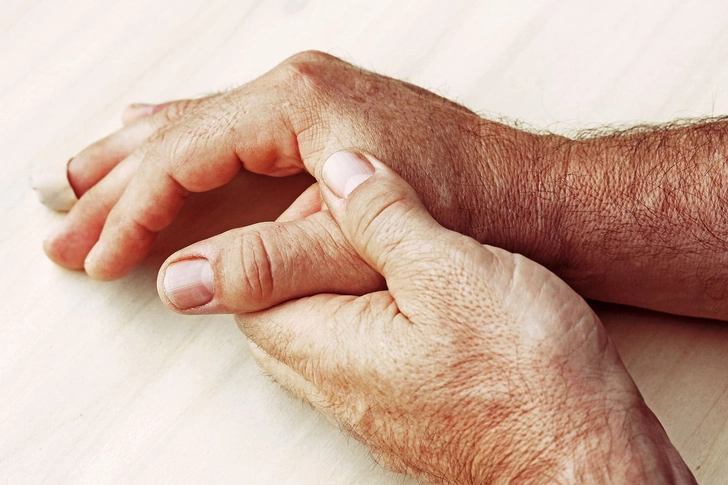 Soothe Arthritis