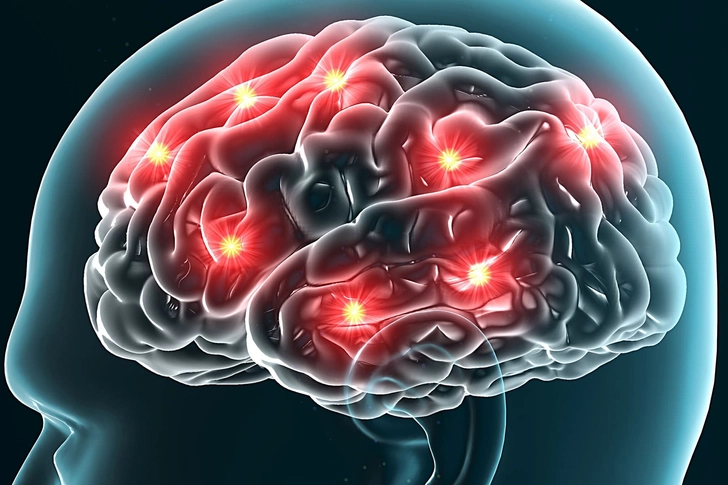 Scramble Pain Signals
