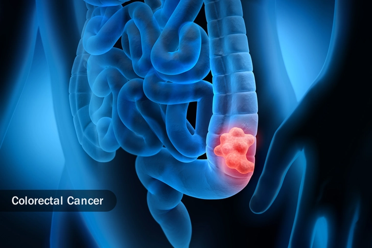 Prevents Cancer