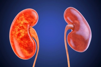 Kidney Disease Kidney Disease