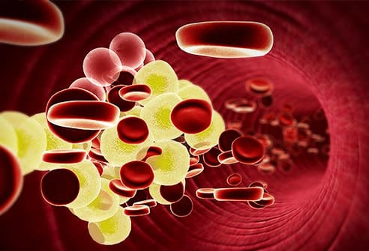 Get Cholesterol Under Control