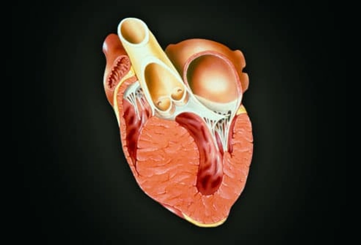 Heart Muscle Disease: Cardiomyopathy