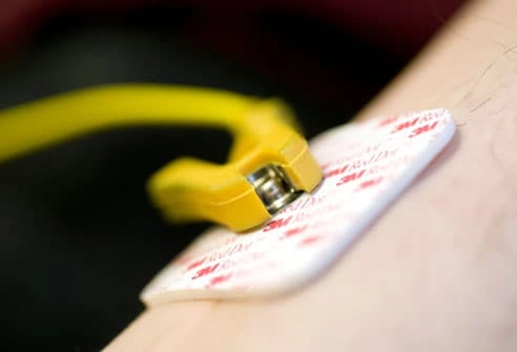 Electrocardiogram (EKG)