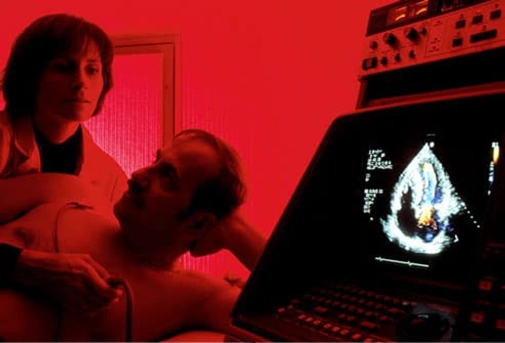 Echocardiogram