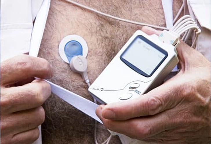 Holter Monitor Holter Monitor