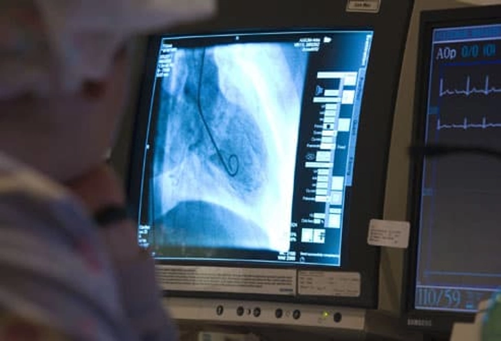 Cardiac Catheterization Cardiac Catheterization