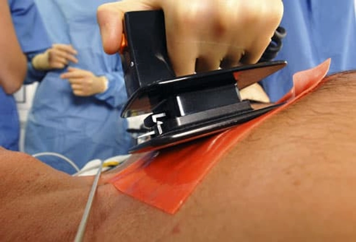 Sudden Cardiac Death