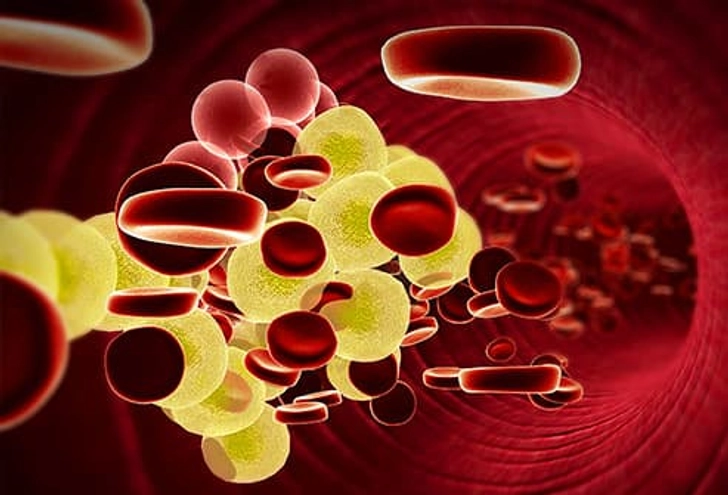 Control Your Cholesterol Control Your Cholesterol
