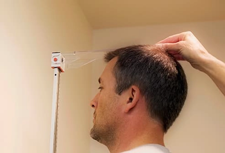 Hair Loss Hair Loss