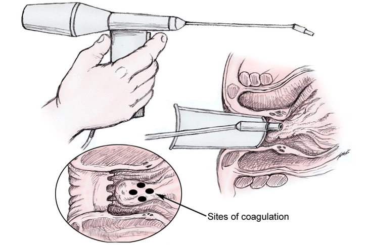 Treatment by a Doctor