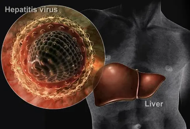 Hepatitis Types and Liver Risks