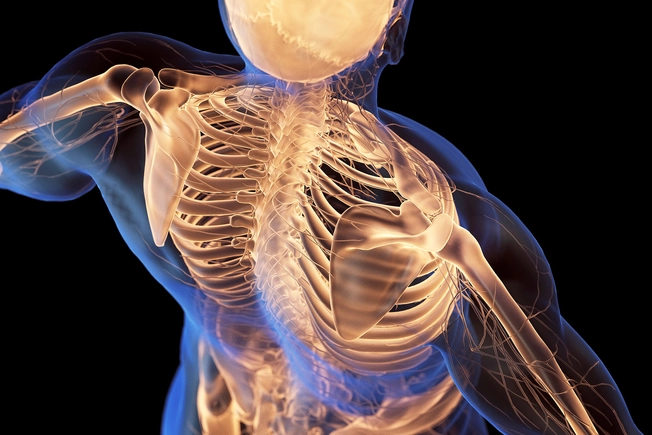 Impact on Bone Health Impact on Bone Health