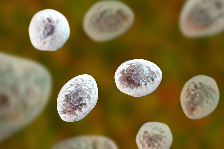 Pneumocystis pneumonia Pneumocystis pneumonia