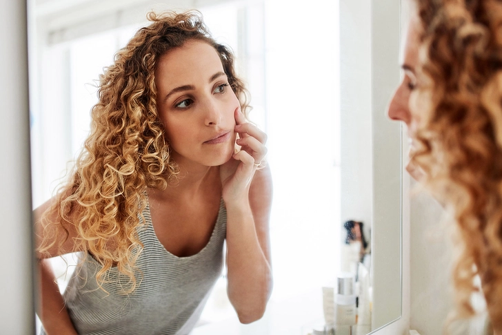 Chronic Acne