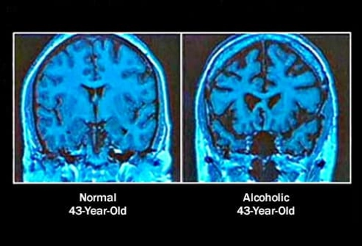 Your Brain Shrinks