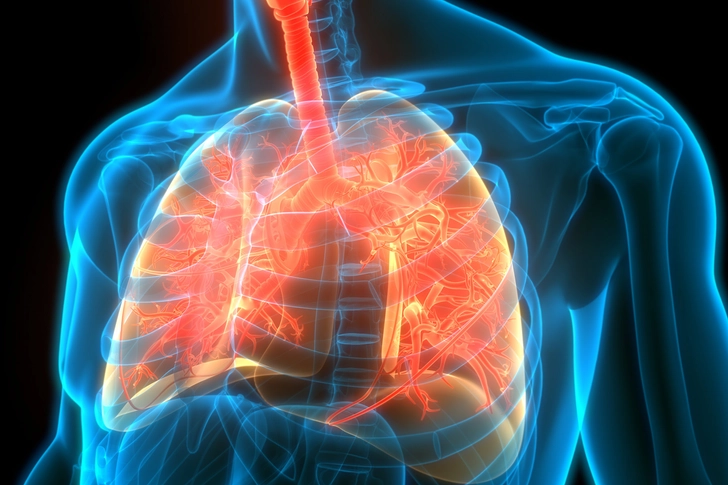 Lower Respiratory Infection Lower Respiratory Infection