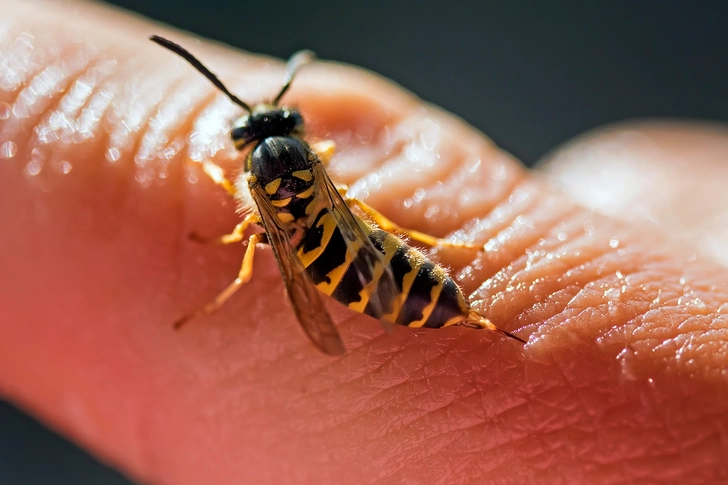 Anaphylaxis