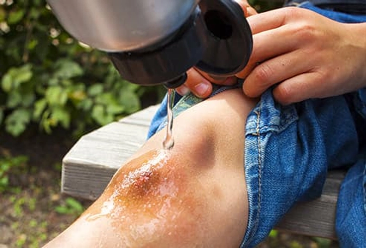 Wound Care Step 2: Rinse Well