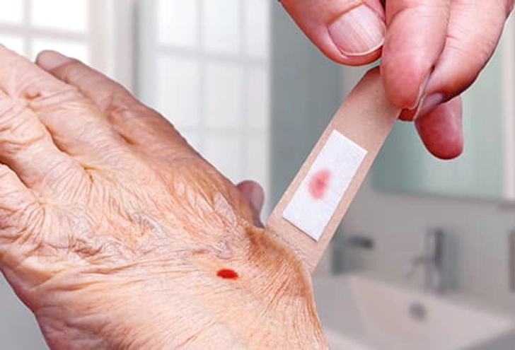 Wound Care Step 7: Change Bandages Wound Care Step 7: Change Bandages