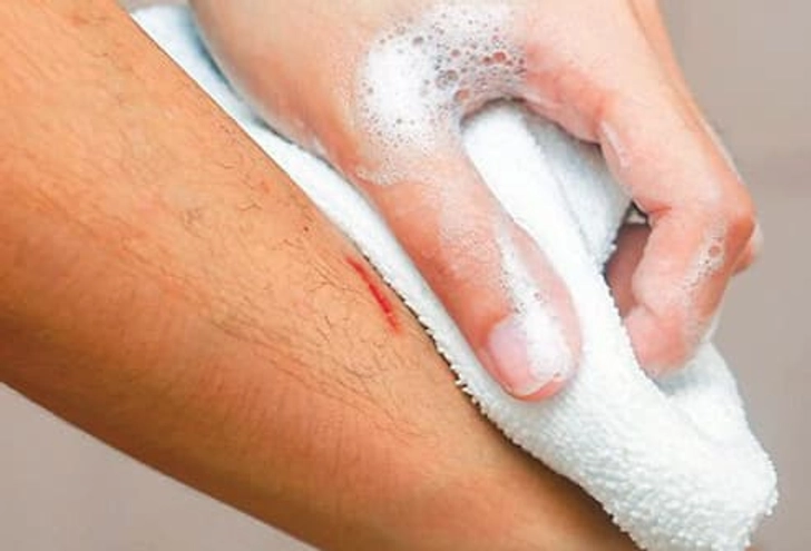 Wound Care Step 3: Wash Around It