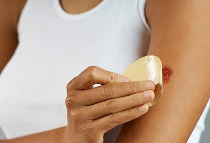 Wound Care Step 6: Bandage Wound Care Step 6: Bandage