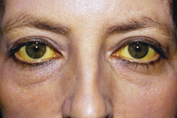 Eyes