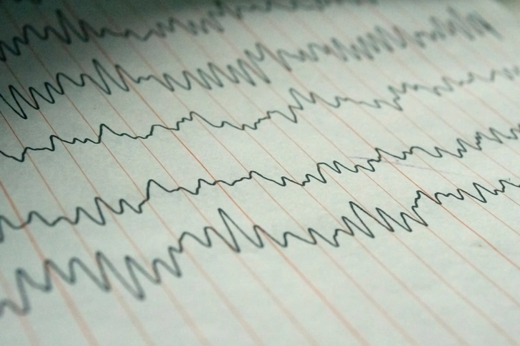 Seizures