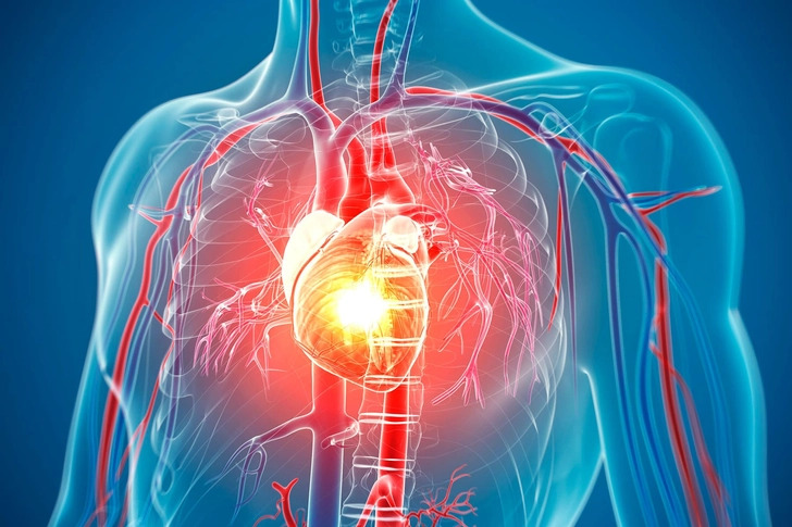 Heart Disease