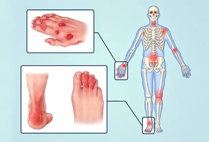 Symptoms Inside and Out Symptoms Inside and Out