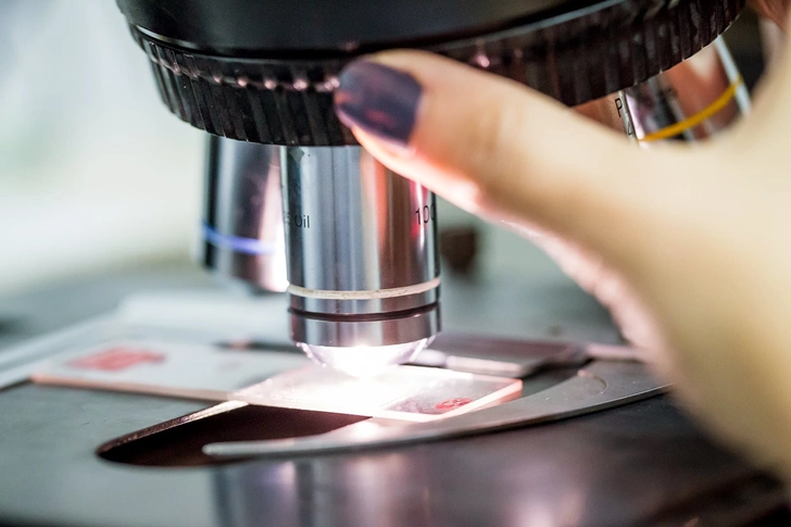 Biopsies Biopsies