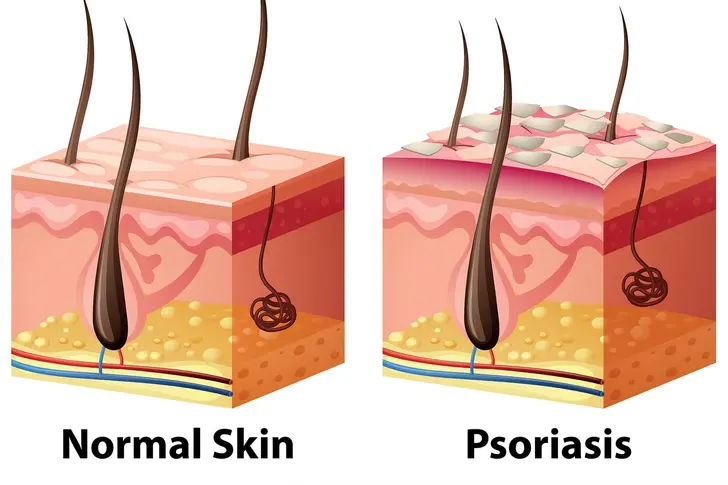 Mild, Moderate, or Severe? Mild, Moderate, or Severe?