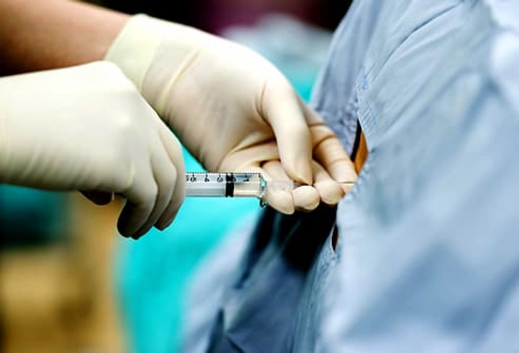 Get an Epidural