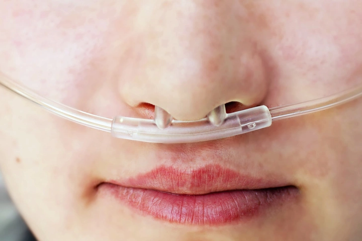 Use Supplemental Oxygen