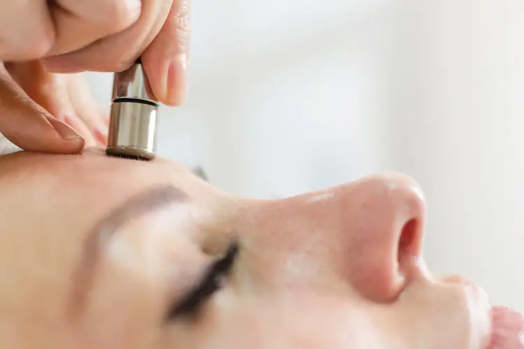 microdermabrasion