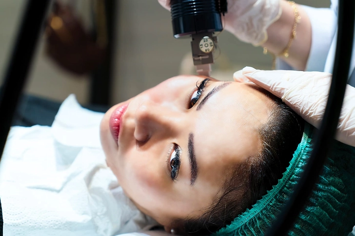 Microneedling