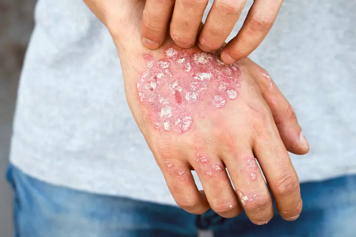 Why Hands Need Special Care