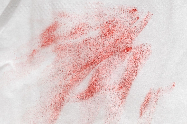 Lip Balm or Lipstick on Clothes Lip Balm or Lipstick on Clothes